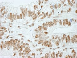 RbBP5 Polyclonal Antibody, Bethyl Laboratories 10 &mu;L; Unconjugated:Antibodies,