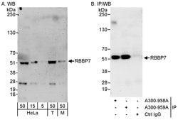 RbBP7 Rabbit anti-Human, Mouse, Polyclonal, Bethyl Laboratories 100 &mu;l;