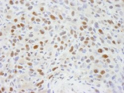 RbBP7 Polyclonal Antibody, Bethyl Laboratories 10 &mu;L; Unconjugated:Antibodies,