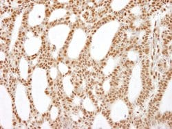 RecQ1 Rabbit anti-Human, Mouse, Polyclonal, Bethyl Laboratories 100 &mu;L;