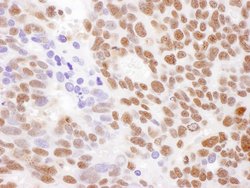RecQ1 Rabbit anti-Human, Polyclonal, Bethyl Laboratories 100 &mu;l; Unlabeled:Antibodies,