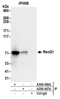 RecQ1 Rabbit anti-Human, Polyclonal, Bethyl Laboratories 100 &mu;l; Unlabeled:Antibodies,
