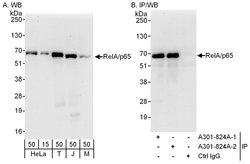 RelA Rabbit anti-Human, Mouse, Polyclonal, Bethyl Laboratories 100 &mu;L;