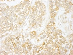 RelA Polyclonal Antibody, Bethyl Laboratories:Antibodies:Primary Antibodies