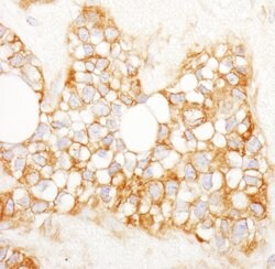 Reticulocalbin-1 Rabbit anti-Human, Polyclonal, Bethyl Laboratories 100