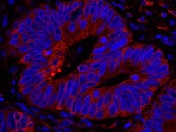 Reticulocalbin-1 Polyclonal Antibody, Bethyl Laboratories 100 &mu;L; Unconjugated:Antibodies,