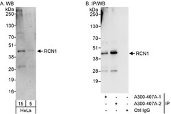 Reticulocalbin-1 Rabbit anti-Human, Polyclonal, Bethyl Laboratories 100