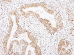 Rictor Rabbit anti-Human, Polyclonal, Bethyl Laboratories 100 &mu;L; Unconjugated:Antibodies,