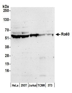 Ro60 Rabbit anti-Human, Mouse, Polyclonal, Bethyl Laboratories 100 &mu;L;