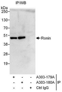 Ronin Rabbit anti-Human, Polyclonal, Bethyl Laboratories 100 &mu;l; Unlabeled:Antibodies,
