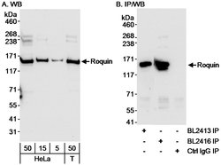 Roquin Rabbit anti-Human, Polyclonal, Bethyl Laboratories 100 &mu;L; Unconjugated:Antibodies,