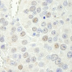 Rtf1 Polyclonal Antibody, Bethyl Laboratories 100 &mu;L; Unconjugated:Antibodies,