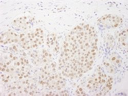 Rtf1 Polyclonal Antibody, Bethyl Laboratories 100 &mu;L; Unconjugated:Antibodies,