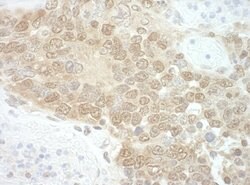 RuvBL2 Polyclonal Antibody, Bethyl Laboratories:Antibodies:Primary Antibodies