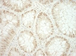 RuvBL2 Polyclonal Antibody, Bethyl Laboratories 10 &mu;L; Unconjugated:Antibodies,