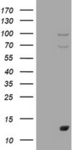 S100A1 Mouse anti-Human, Clone: OTI6G4, lyophilized, TrueMAB 100 &mu;g;