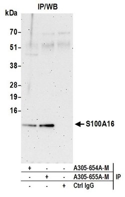 S100A16 Polyclonal Antibody, Bethyl Laboratories 20 &mu;L; Unconjugated:Antibodies,