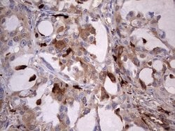 S100A9 Monoclonal Antibody (OTI2C5), TrueMAB , OriGene 100 &mu;L; Unconjugated:Antibodies,