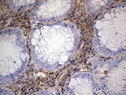 S100A9 Mouse anti-Human, Clone: OTI2A2, lyophilized, TrueMAB 100 &mu;g;
