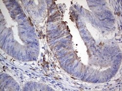 S100A9 Mouse anti-Human, Clone: OTI2A2, lyophilized, TrueMAB 100 &mu;g;