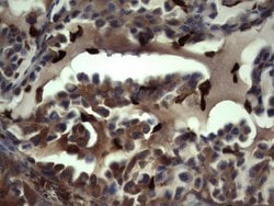 S100A9 Monoclonal Antibody (OTI8C2), TrueMAB , OriGene 100 &mu;L; Unconjugated:Antibodies,