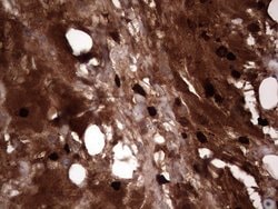 S100A9 Monoclonal Antibody (OTI8C2), TrueMAB , OriGene 100 &mu;L; Unconjugated:Antibodies,
