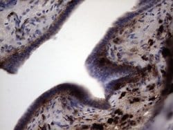 S100A9 Monoclonal Antibody (OTI8C2), TrueMAB , OriGene:Antibodies:Primary