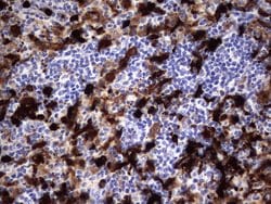 S100A9 Monoclonal Antibody (OTI8C2), TrueMAB , OriGene:Antibodies:Primary