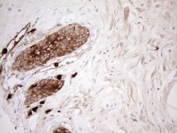S100A9 Monoclonal Antibody (OTI13E12), TrueMAB , OriGene 100 &mu;L; Unconjugated:Antibodies,
