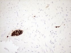 S100A9 Monoclonal Antibody (OTI13E12), TrueMAB , OriGene 100 &mu;L; Unconjugated:Antibodies,
