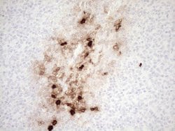 S100A9 Monoclonal Antibody (OTI13E12), TrueMAB , OriGene 100 &mu;L; Unconjugated:Antibodies,