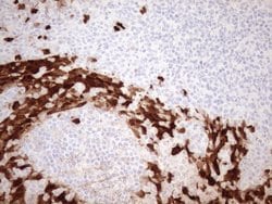 S100A9 Monoclonal Antibody (OTI13E12), TrueMAB , OriGene 100 &mu;L; Unconjugated:Antibodies,