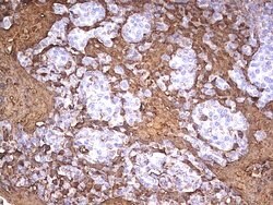 S100A9 Mouse anti-Human, Clone: UMAB173, liquid, UltraMAB 30 &mu;L | Buy Online | OriGene | Fisher Scientific