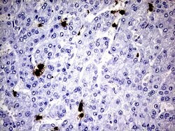 S100A9 Mouse anti-Human, Clone: UMAB173, liquid, UltraMAB 30 &mu;L | Buy Online | OriGene | Fisher Scientific