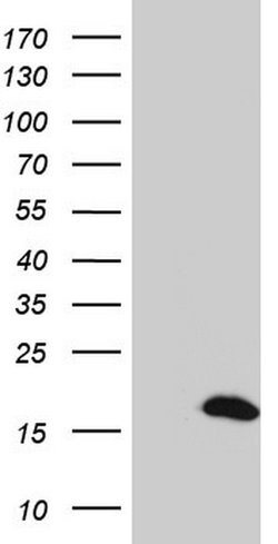 S100A9 Monoclonal Antibody (OTI2C5), TrueMAB , OriGene 100 &mu;L; Unconjugated:Antibodies,