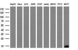 S100A9 Mouse anti-Human, Clone: OTI2A2, lyophilized, TrueMAB 100 &mu;g;