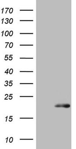 S100A9 Monoclonal Antibody (OTI13E12), TrueMAB , OriGene 100 &mu;L; Unconjugated:Antibodies,