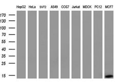 S100A9 Monoclonal Antibody (OTI13E12), TrueMAB , OriGene 100 &mu;L; Unconjugated:Antibodies,