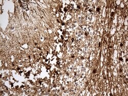 S100B Monoclonal Antibody (OTI3G6), TrueMAB , OriGene 100 &mu;L; Unconjugated:Antibodies,