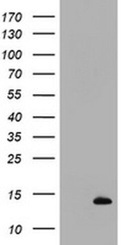 S100B Monoclonal Antibody (OTI6C5), TrueMAB , OriGene 100 &mu;L; Unconjugated:Antibodies,