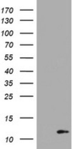 S100B Mouse anti-Human, Clone: OTI2H7, lyophilized, TrueMAB 100 &mu;g;