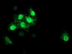 S100P Monoclonal Antibody (OTI1A4), TrueMAB , OriGene 30 &mu;L; Unconjugated:Antibodies,