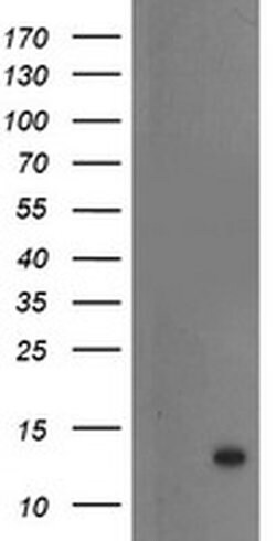 S100P Monoclonal Antibody (OTI1A4), TrueMAB , OriGene:Antibodies:Primary