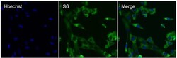 Invitrogen S6 Recombinant Rabbit Monoclonal Antibody (9H8L2) 100 &mu;g;