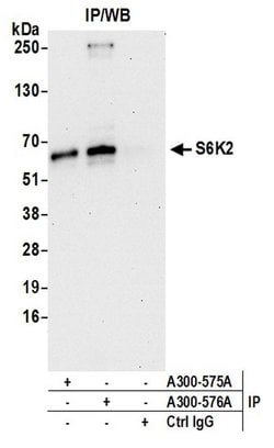 S6K2 Rabbit anti-Human, Polyclonal, Bethyl Laboratories 10 &mu;L; Unconjugated:Antibodies,