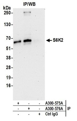 S6K2 Rabbit anti-Human, Mouse, Polyclonal, Bethyl Laboratories 100 &mu;L;