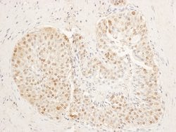 SA1 Rabbit anti-Human, Polyclonal, Bethyl Laboratories 10 &mu;L; Unconjugated:Antibodies,
