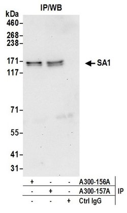 SA1 Goat anti-Human, Polyclonal, Bethyl Laboratories 100 &mu;L; Unconjugated:Antibodies,