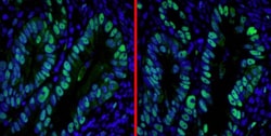 Invitrogen Donkey anti-Rabbit IgG (H+L) Cross-Adsorbed Secondary Antibody,