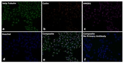 Invitrogen&trade;&nbsp;Goat anti-Mouse IgG2a Superclonal&trade; Secondary Antibody, Alexa Fluor&trade; Plus 555